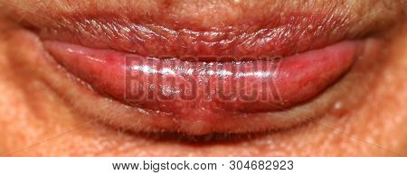 Lips Close Up. Wrinkles On The Lips. Botex Of The Lips. Boteks.