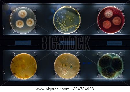 Different Samples With Kinds Of Bacterias Living At Common Household Items. Penicillium Citrinum, St