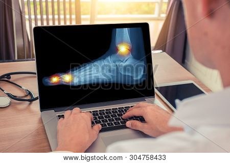 Doctor Watching A X-ray Of Pain In The Toe And The Ankle Of A Foot.