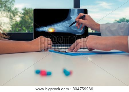 Doctor Showing A X-ray Of A Foot With Pain Under On A Laptop To A Woman Patient.
