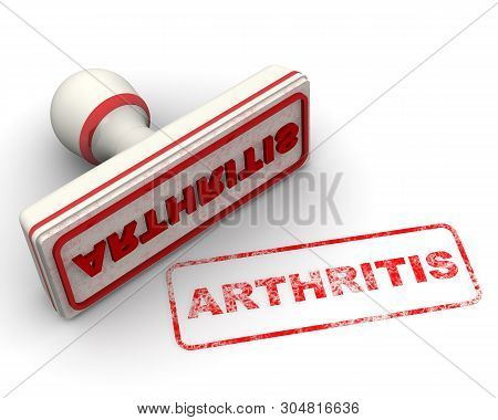 Arthritis. Seal And Imprint. Red Rubber Stamp And Red Print Arthritis On White Surface. Isolated. 3d
