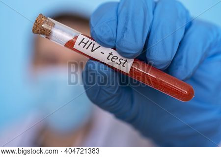A Test Tube With Blood For An Hiv Test Is Held By A Doctor's Hand In Medical Gloves. The Concept Of 