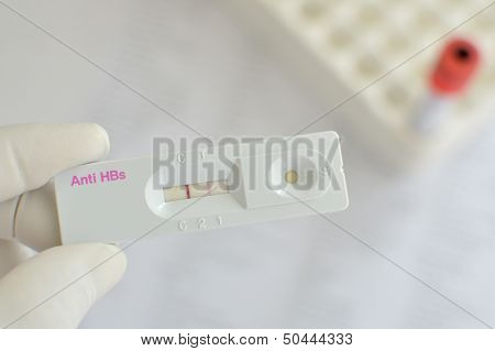 Anti-HBs positive