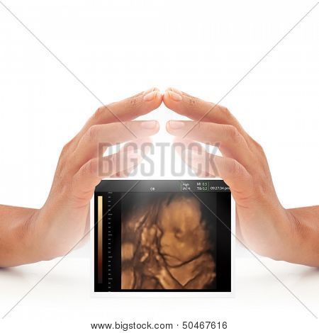Woman hands over ultrasound of baby in mother's womb. Pregnancy care concept.