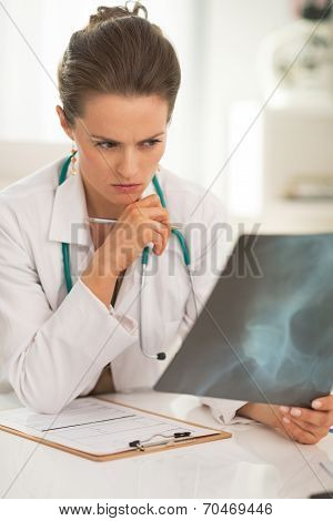 Concerned Doctor Woman Looking On Fluorography