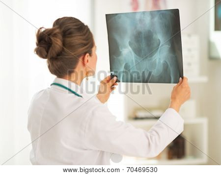 Doctor Woman Looking On Fluorography. Rear View