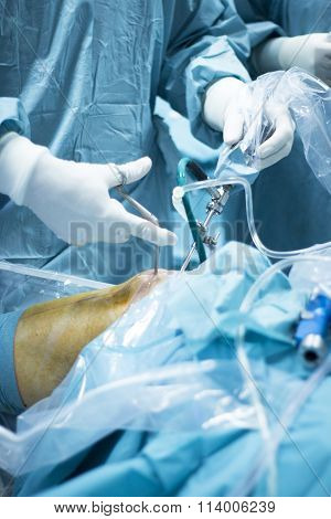 Knee Arthroscopy Orthopedic Surgery Operation