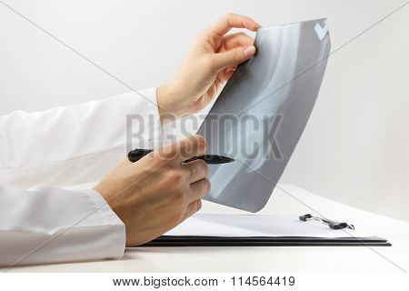 Healthcare and medicine concept - doctor with medical clipboard analyzing leg knee roentgen or x-ray