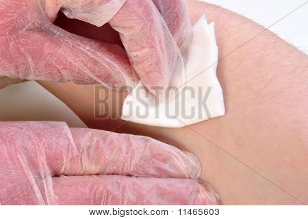 Tisk nesterilním tampon na místo vpichu