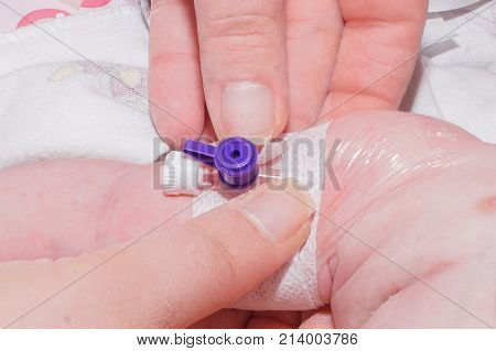Intravenous catheterization of newborn baby close-up in neonatal intensive care unit at children's hospital.