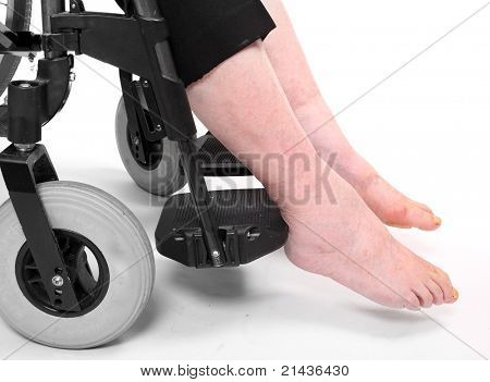 휠체어에 앉아있는 노인 하반신 마비 여자의 다리 질병. 부동은 유.