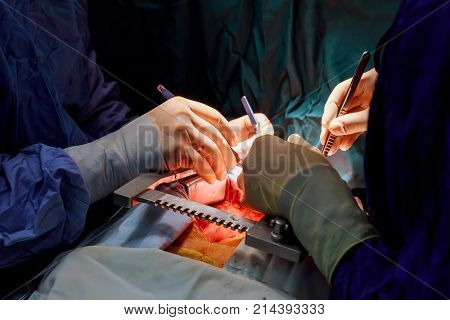 Soft natural background. Surgeon during an operation on the open heart