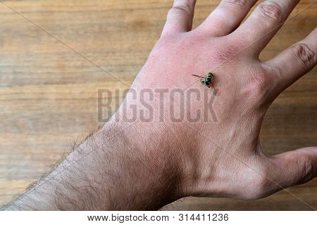 Male Hand Stung By Bee Or Wasp. Hand Swelling, Inflammation, Redness Are Signs Of Infection. Insect