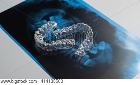Transparent Bite Correction Trays And X-ray Of The Jaw. Orthodontist Equipment