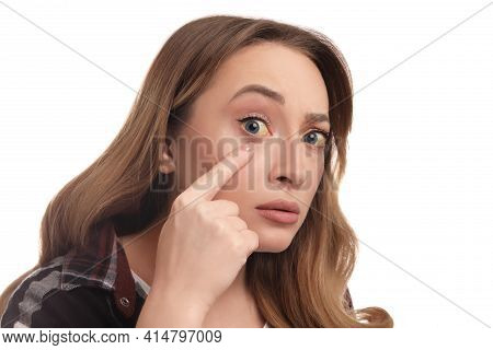 Woman With Yellow Eyes On White Background. Liver Problems Symptom