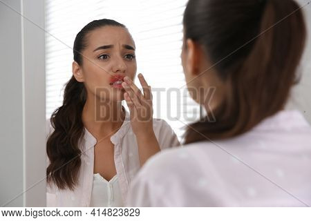 Young Woman With Herpes Touching Lips In Front Of Mirror At Home