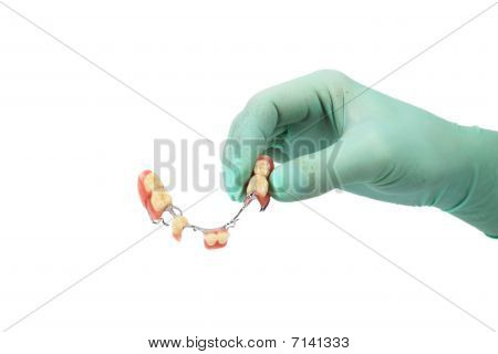 Porzellan-Kronen, Brücke (Zahnmedizin), Dental-Platte