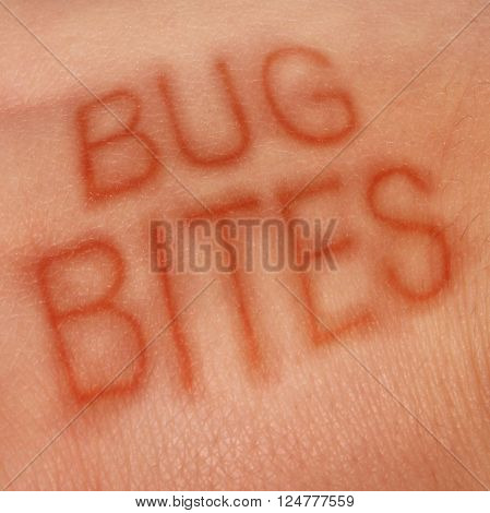 Bug bites medical concept and health care symbol for insect bite infection or skin irritation as human epidermis as text shaped in sores as for lym disease or dengue fever or zika virus and malaria.