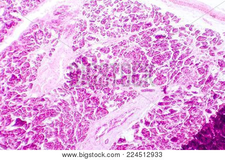 Histology of human pancreatic tissue. Light micrograph of pancreas showing islets where insulin is produced