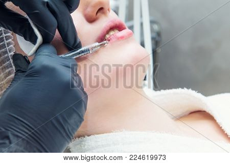 Contour plastic: Dermatologist doctor inject filler. Close up female hands of cosmetologist making injection in lips. Aesthetic cosmetology. Selective focus