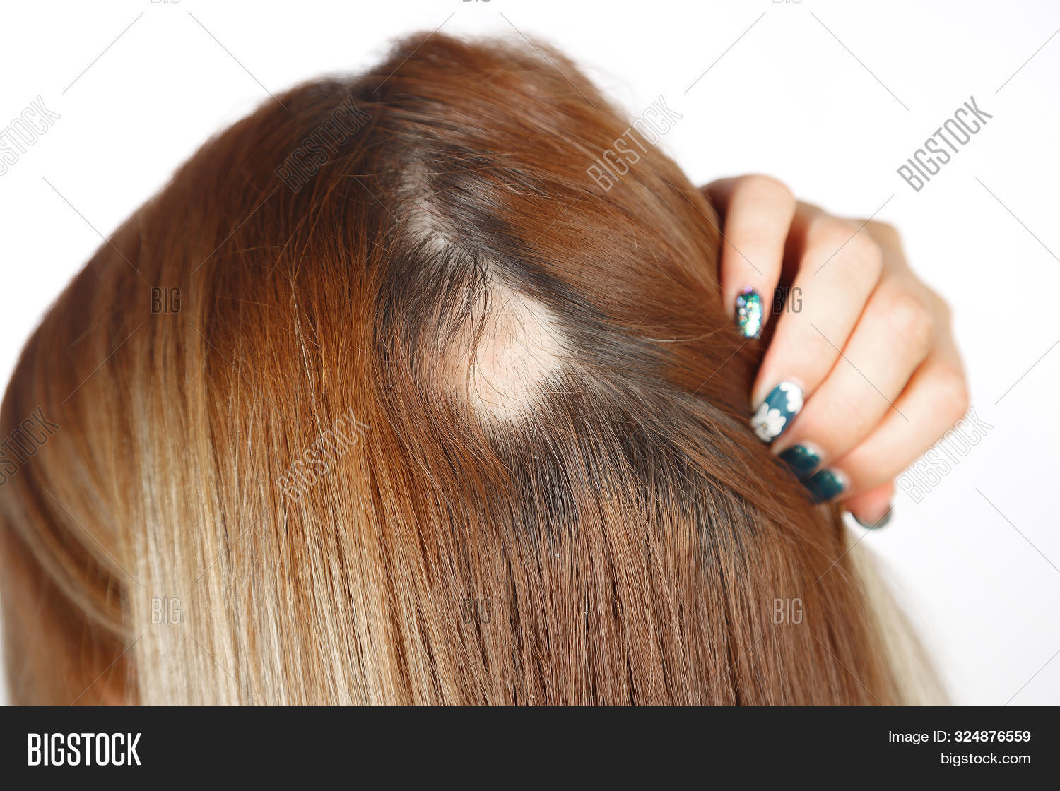 30 Year Old Caucasian Image Photo Free Trial Bigstock