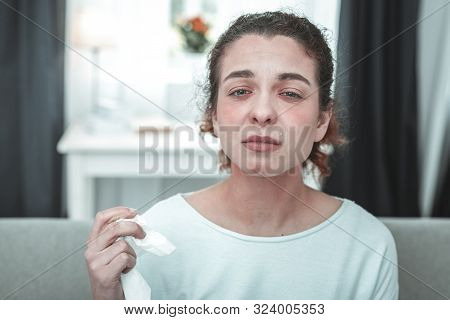 Green-eyed Woman Having Tears After Sneezing Because Of Allergy