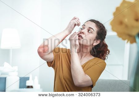 Curly Woman With Scratches On Elbow Dropping Her Eyes