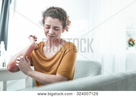 Curly Red-haired Woman Feeling Ache On Her Arm After Allergy