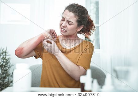 Curly Woman Taking Bracelet Off While Having Rash On Wrist