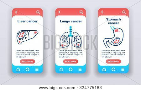 Malignant Neoplasm, Metastases On Mobile App Onboarding Screens. Ui Ux Gui Template.