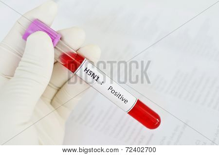 H5N1 positive