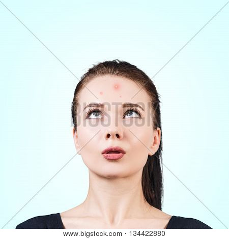 Confused teenage girl looking up on her forehead. Problem skin concept.
