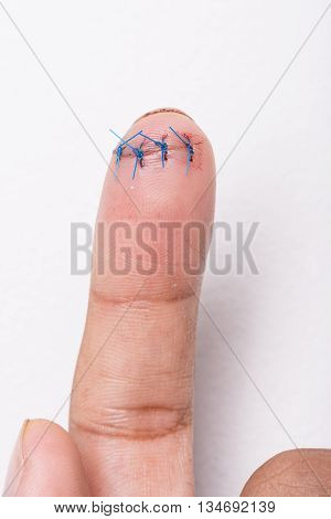closeup wound on finger with surgical stitch