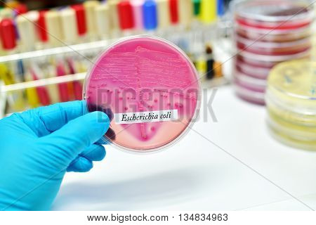 Colonies of Escherichia coli bacteria in culture medium plate