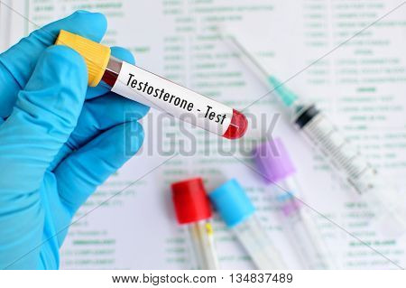 Test tube with blood sample for testosterone hormone test