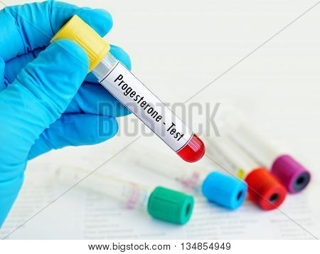 Test tube with blood sample for progesterone test