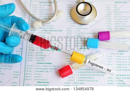 Test tube with blood sample for progesterone test