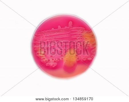 Colonies of bacteria in culture medium plate