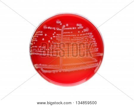 Colonies of bacteria in culture media plate