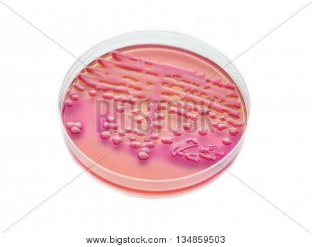 Colonies of bacteria in culture media plate