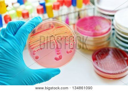 Colonies of bacteria in culture medium plate