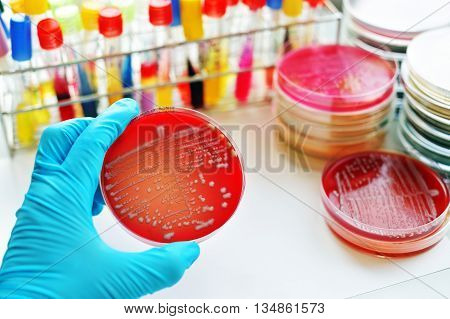 Colonies of bacteria in culture medium plate