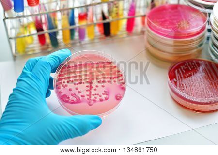 Colonies of bacteria in culture medium plate
