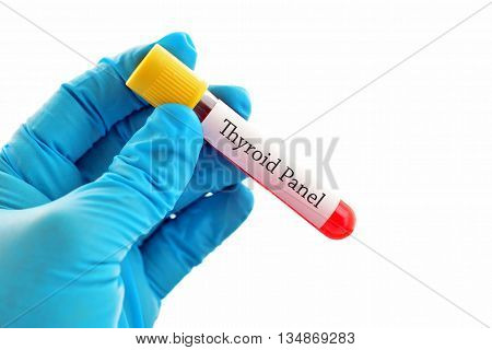 Test tube with blood sample for thyroid hormone test