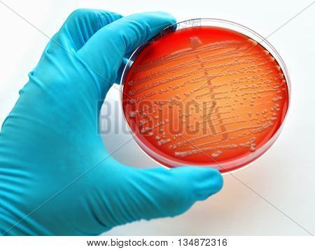 Colonies of bacteria in culture medium plate