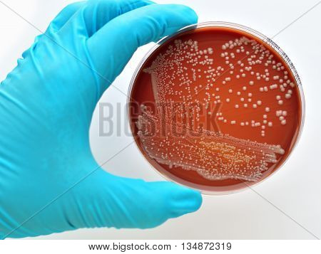 Colonies of bacteria in culture medium plate