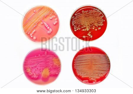 Colonies of bacteria in culture medium plate