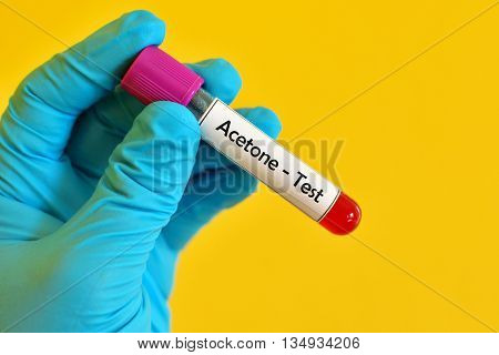 Test tube with blood sample for acetone test
