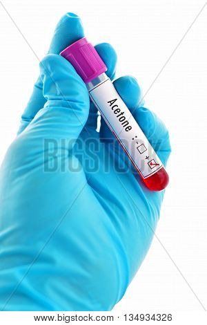 Blood sample positive with acetone chemical testing