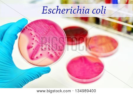 Colonies of Escherichia coli in culture medium plate